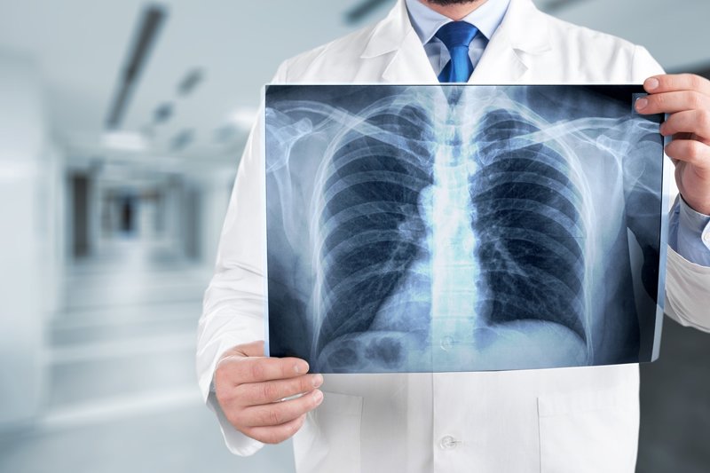 Pneumologia e Tisiologia 