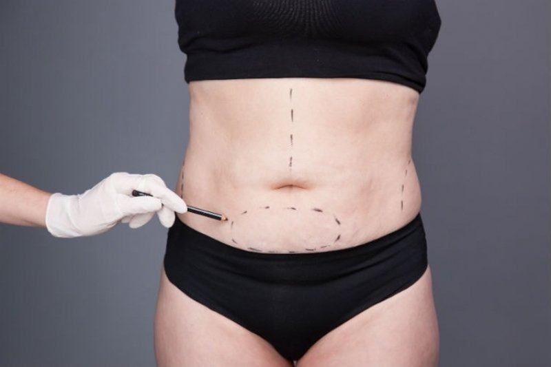 Cirurgia Plástica